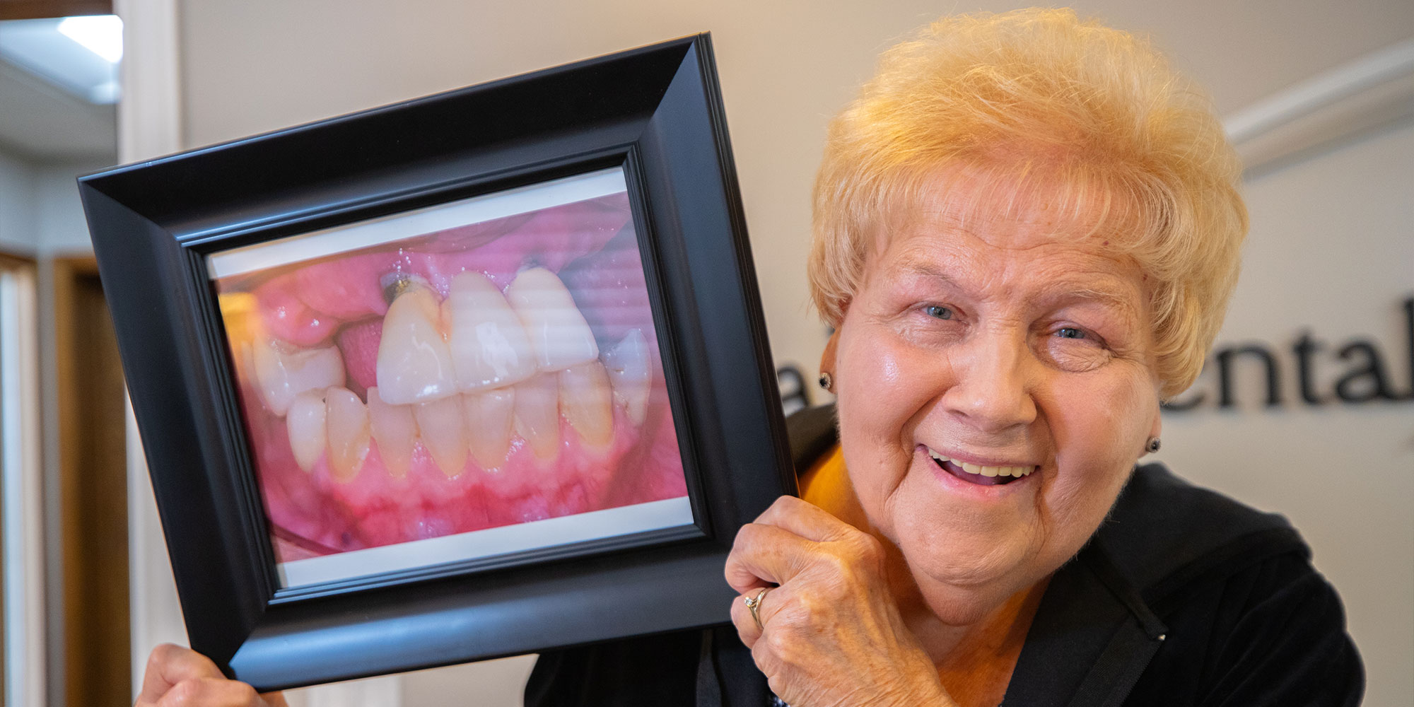 headshot of patient smiling inside of the dental center