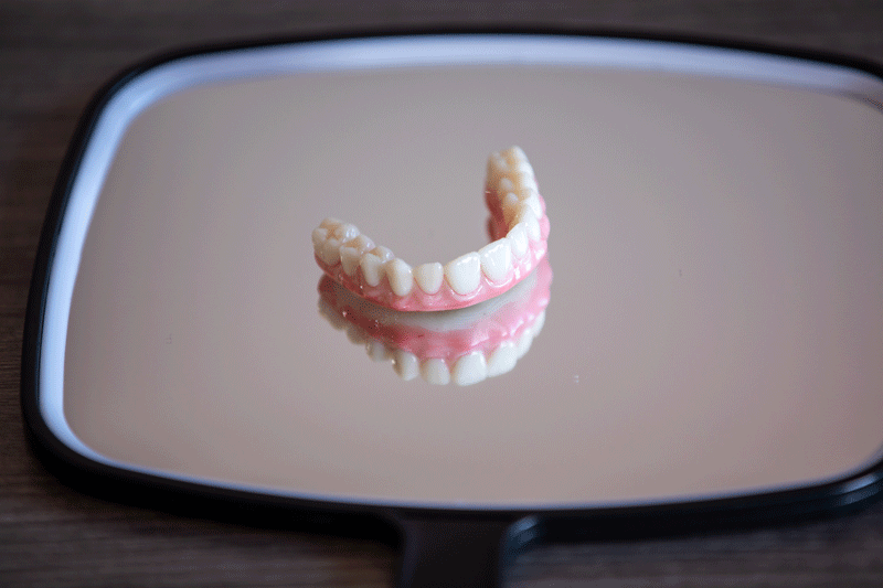 a full arch of teeth sitting on top of a mirror ready to be shown to the client