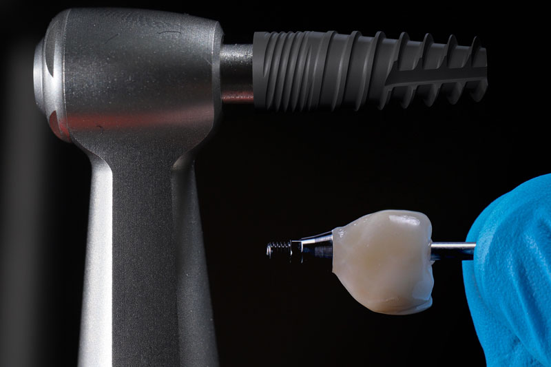 a drill with an implant attached to it and a crown on top with a screw