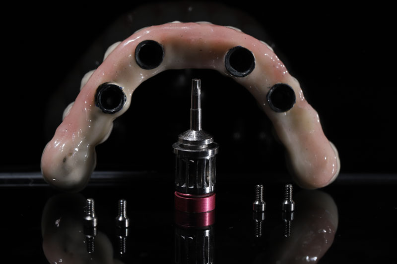 a full mouth dental implant arch with all the tools to place it infront of it